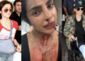 Bollywood divas who got hurt on set