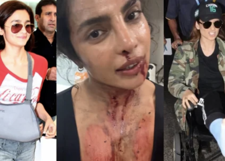Bollywood divas who got hurt on set