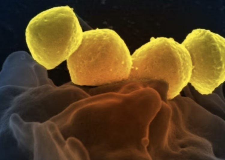 Japan, Flesh-Eating Bacteria, Necrotizing Fasciitis, Health Alert, Public Health, Bacterial Infections