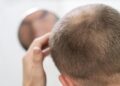 Oral minoxidil emerges as convenient treatment for hair loss, dermatologists say. (Freepik)