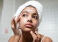 6 powerful skincare treatments to erase dark spots and achieve radiant skin