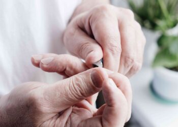 Your nails can reveal psoriasis and more: Doctor explains 5 hand and nail changes that may signal hidden disease